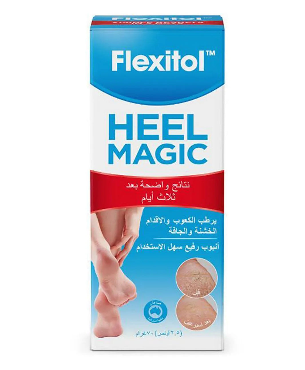 FLEXITOL Heel Magic Cream - Intensive Foot Moisturizer with Shea Butter & Olive Oil for Dry Heels, 70g